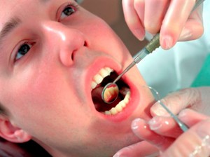 การรักษาโรค diastema เริ่มต้นด้วยการตรวจที่ทันตแพทย์