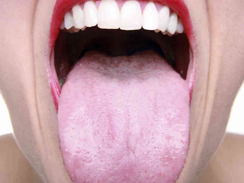 ทำไมในภาษาของบานสีขาว เป็นสีขาวบานบนลิ้น